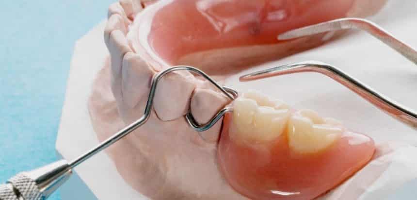 Protezy zębowe w UK rodzaje i ceny