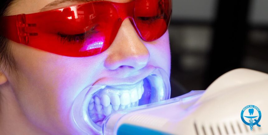 Избелване на зъби с LED лампа - какво включва и колко струва?