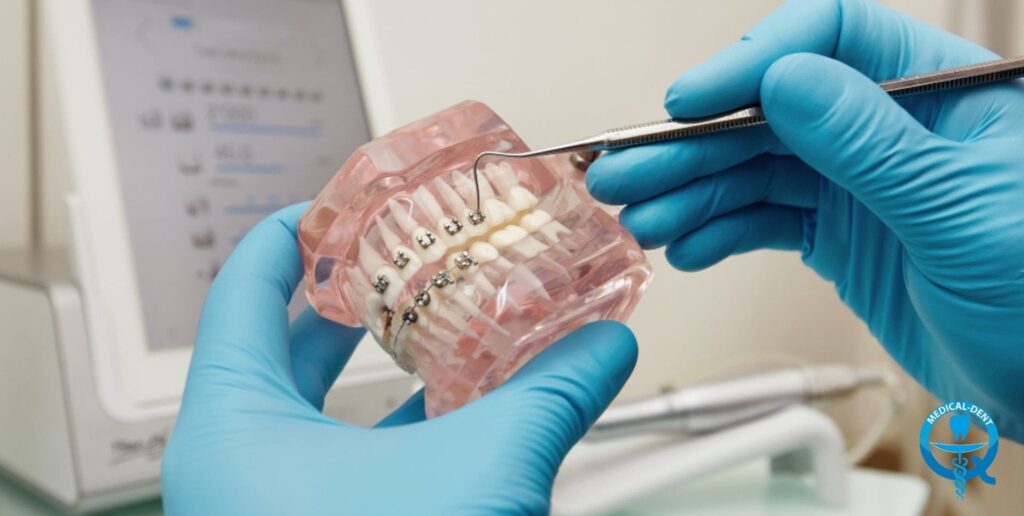 The image shows the hands of a dentist wearing blue gloves, holding a transparent plastic model of a dentition with metal brackets. In the background, dental instruments and a close-up of part of a medical form are visible.