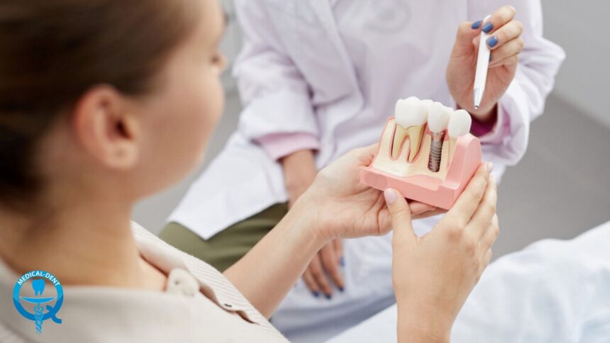 Dental implant in the UK - what does it look like, what are its benefits and how much does it cost?