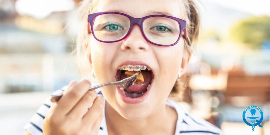 The photograph shows a close-up of the face of a young person wearing purple glasses and braces on her teeth. The person is opening her mouth wide and inserting a toothbrush into it, as if she is about to clean the braces. The background shows a blurred, natural outdoor environment, suggesting that the photo was taken outdoors.