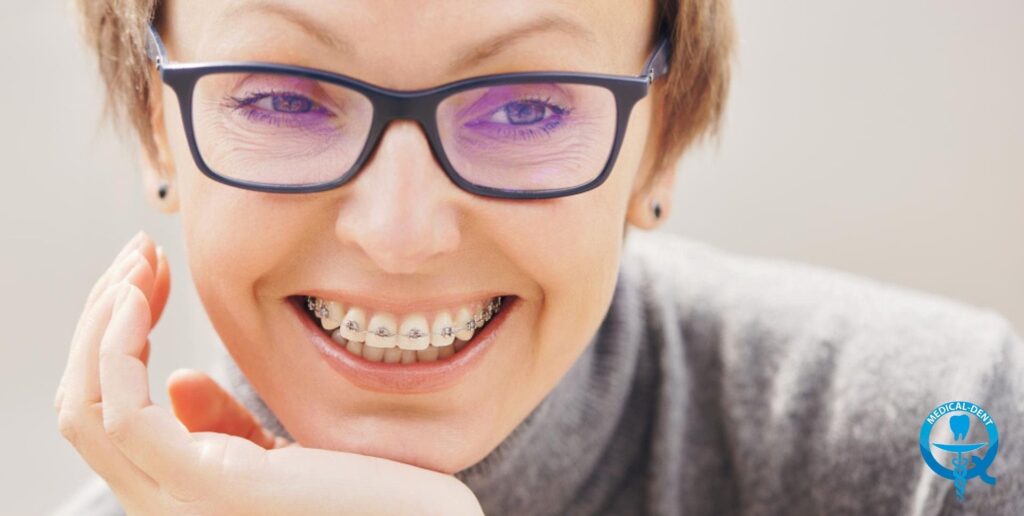 The image shows a close-up on the smiling face of a person wearing dark spectacle frames and braces on their teeth. The mouth is wide open, showing the teeth glistening with braces. The eyes are intense blue and the hair is light. A dental logo appears at the bottom of the frame.