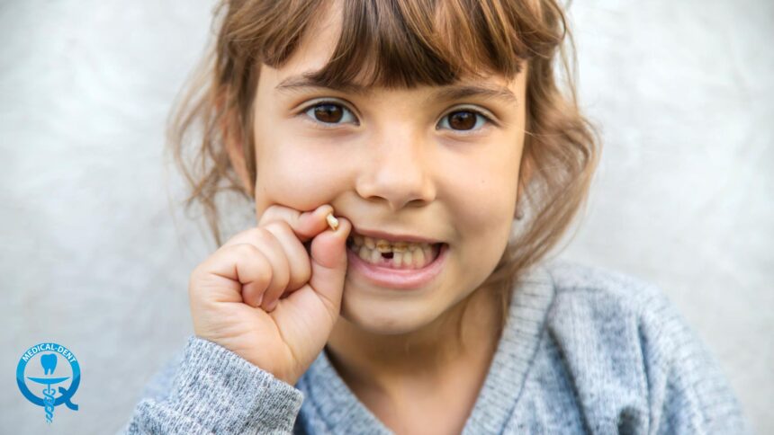 Injuries to deciduous teeth