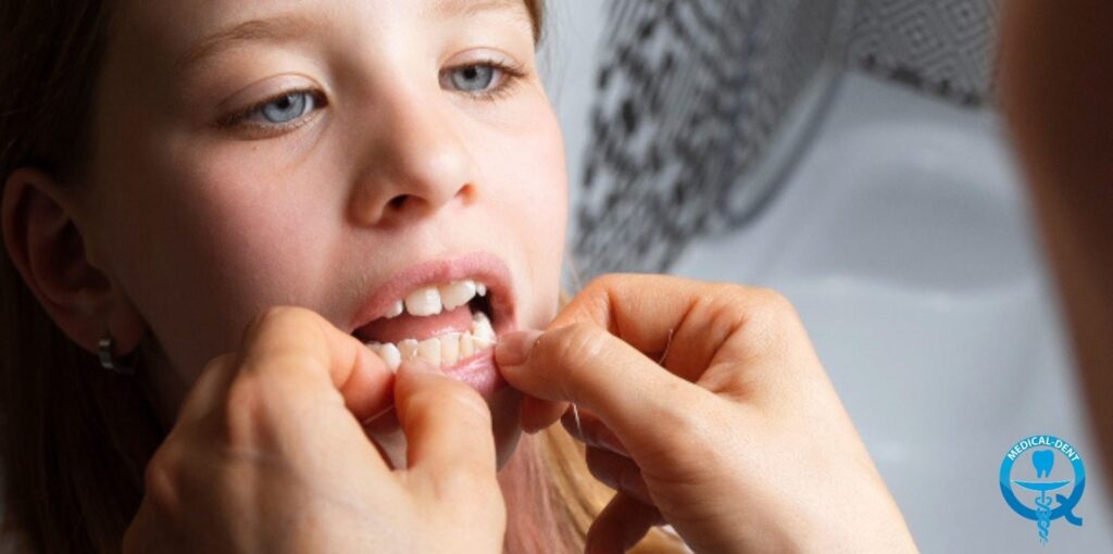 The painting shows a close-up of a child's face as she pushes her lips apart, showing a damaged milk tooth. An adult's hand can also be seen gently touching the child's tooth. The photograph is intended to illustrate the theme of milk tooth injury in children.