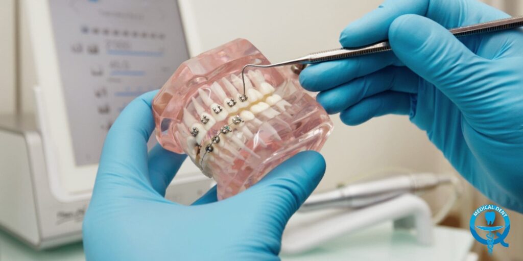 Fotografia arată o persoană cu mănuși albastre care ține în mână un model transparent al dentiției pe care este montat un aparat ortodontic format din sârme metalice și bracket-uri. Un instrument metalic este utilizat pentru a face ajustări la firele din aparat. În fundal sunt vizibile fișe medicale.